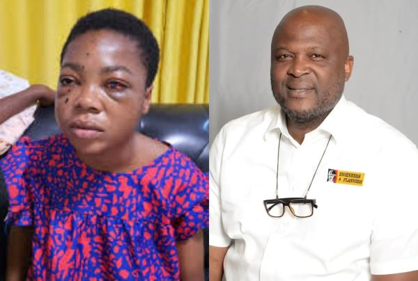 Philanthropist Ibrahim Mahama Supports Schoolgirl Shot in Eye Philanthropist Ibrahim Mahama Supports Schoolgirl Shot in Eye