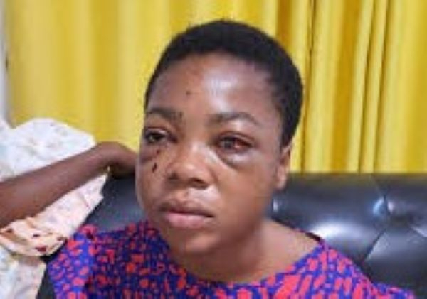 Heartfelt Appeal: Suzzy Pinaman Seeks Assistance After Tragic Incident Heartfelt Appeal: Suzzy Pinaman Seeks Assistance After Tragic Incident